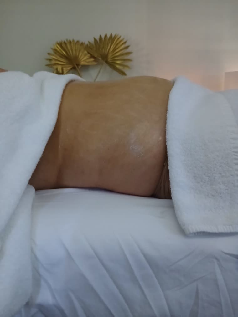 Resultado depois da drenagem linfática, 1 sessão na Essence Wellness Gaia